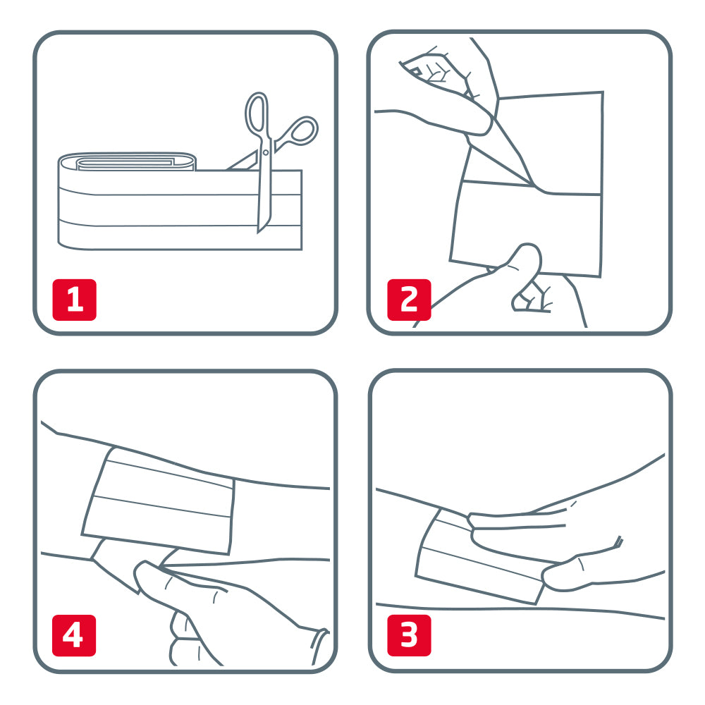 Leukoplast Elastic, Meterware – Anwendung Schritt für Schritt