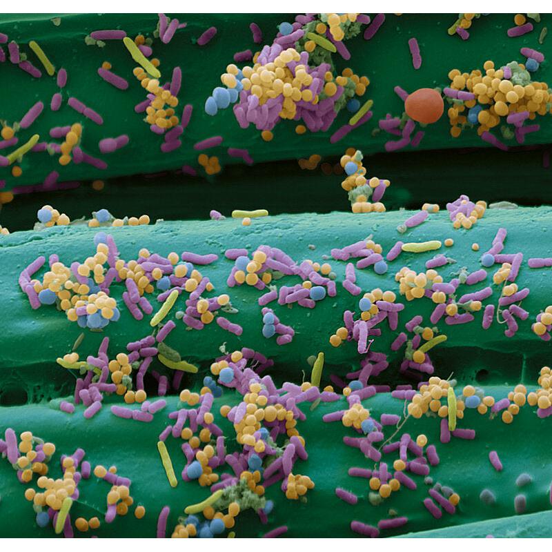 Cutimed Sorbact, Tamponade, antimikrobielle Wundauflage, steril – im Einsatz